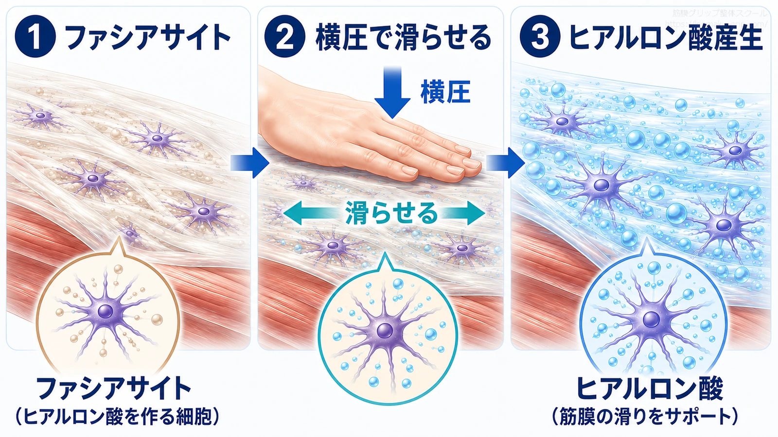 筋膜内のファシアサイトが横圧と滑走の刺激を受け、ヒアルロン酸を産生する流れを3ステップで示した図