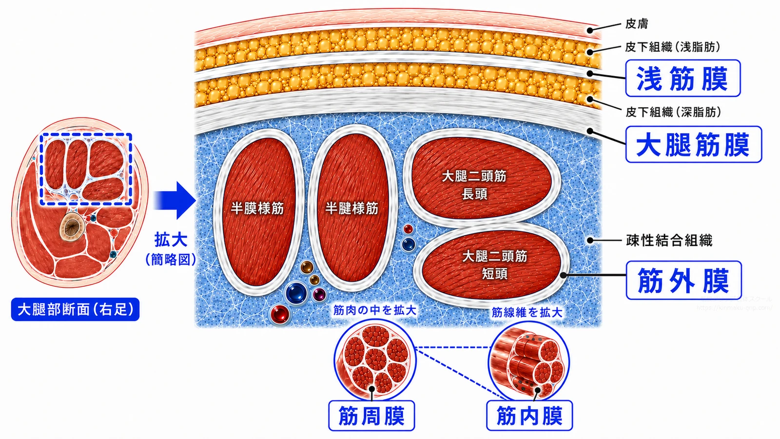 右大腿部の断面と拡大図で、浅筋膜・大腿筋膜・筋外膜・筋周膜・筋内膜という治療に関わる5種類の筋膜の位置を示した図解