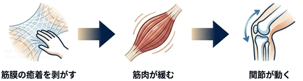 筋膜の癒着を手で剥がし、筋肉が緩んで関節が動くまでの3ステップを示した図解